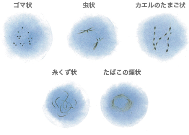 診療内容 フレスポ八潮2f 八潮駅前眼科